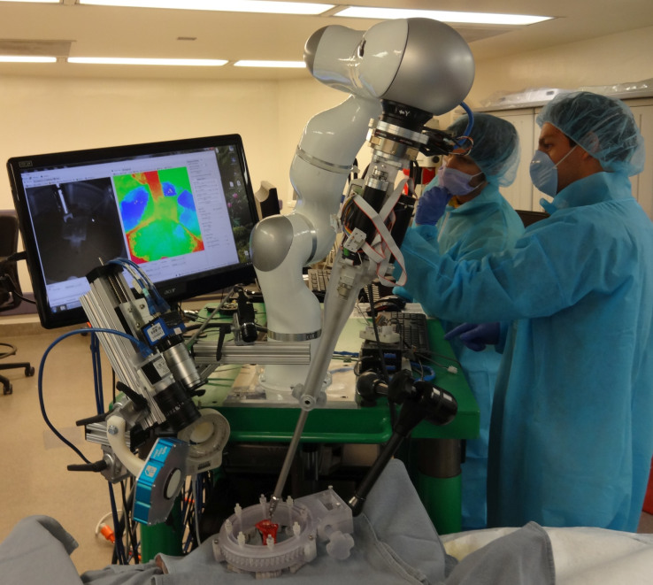 Robot surgeon outperforms human colleagues doing same procedure