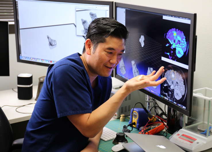 3D printing brain scans helps doctors with a tricky diagnosis